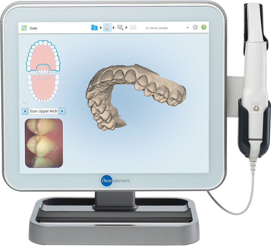 itero-scanner Madison Family Dental Centre Burnaby